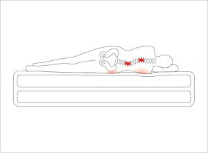 Mattress that is not customized, causing back pain